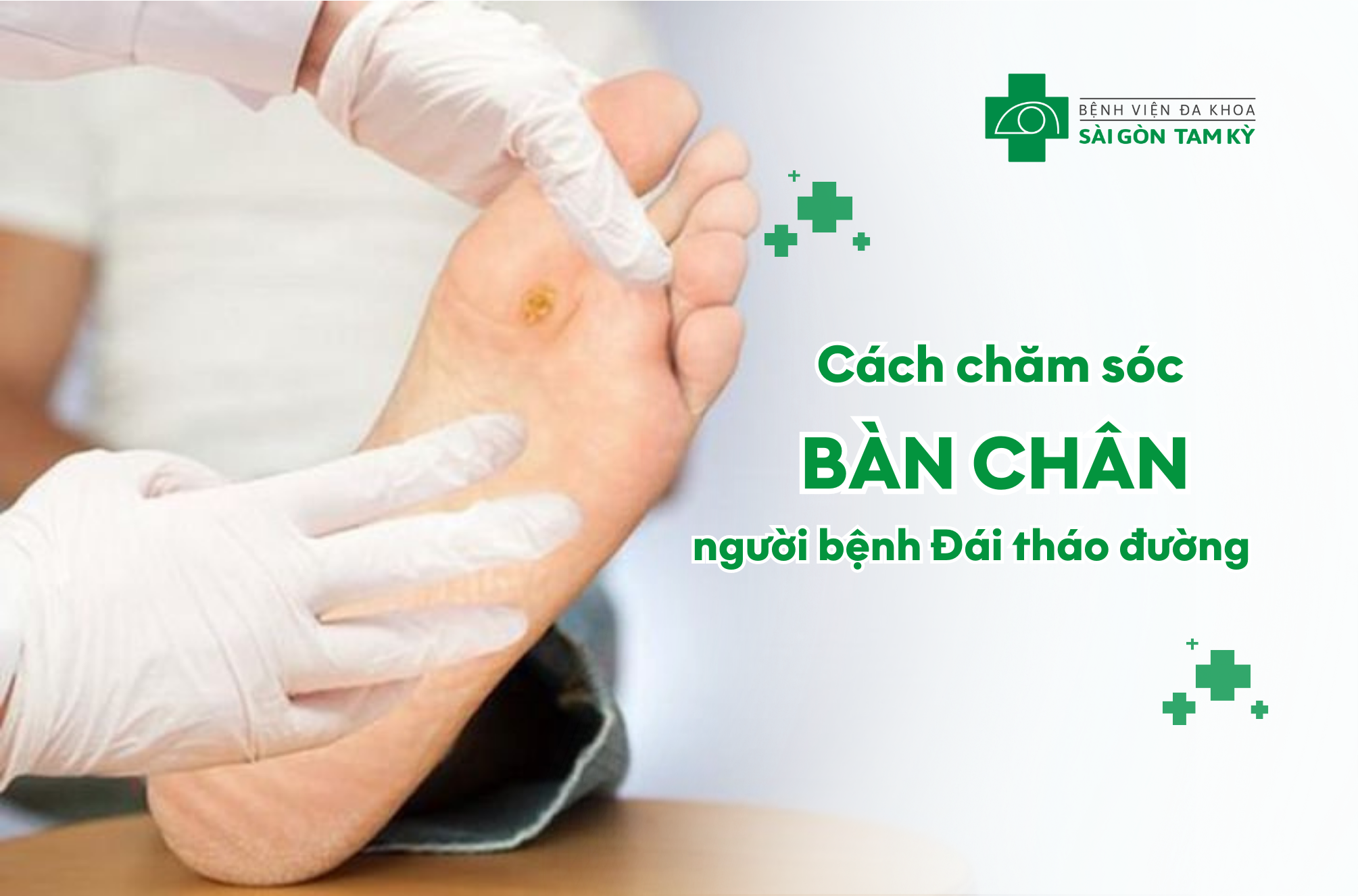 CÁCH CHĂM SÓC BÀN CHÂN BỆNH NHÂN ĐÁI THÁO ĐƯỜNG