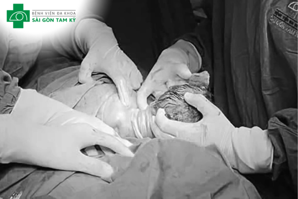 BÉ GÁI CHÀO ĐỜI AN TOÀN VỚI 4 VÒNG RỐN QUẤN CHẶT Ở CỔ